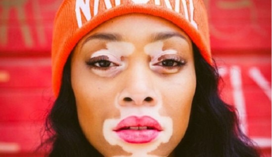Chantelle-Brown-550x318