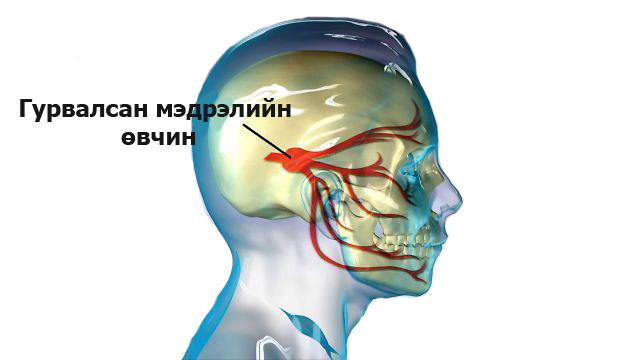 Medreliin-uvdult-copy