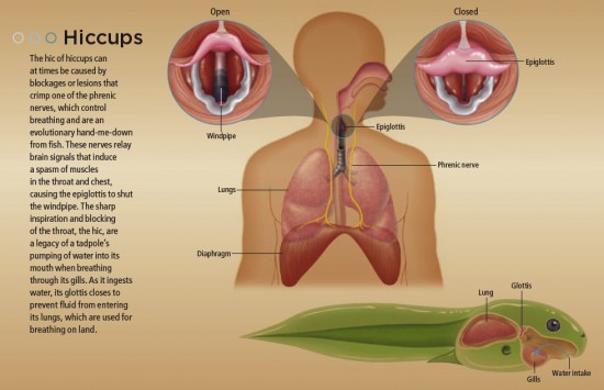 hiccups3-550x355