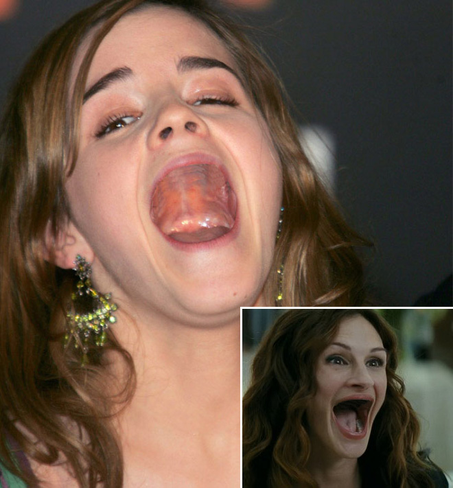 teeth20