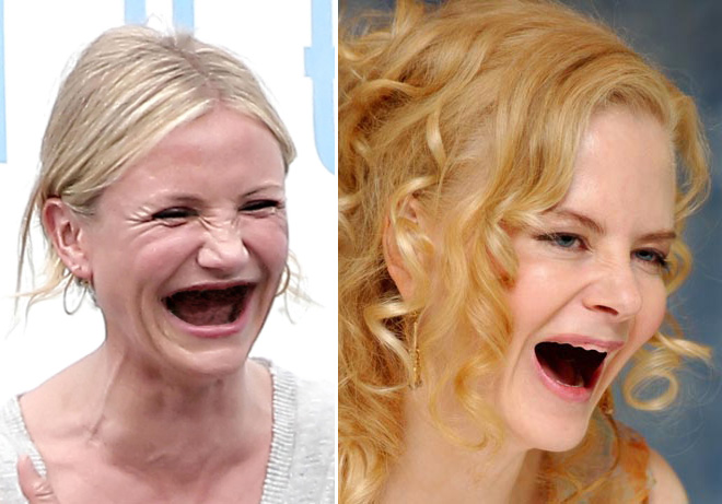 teeth7