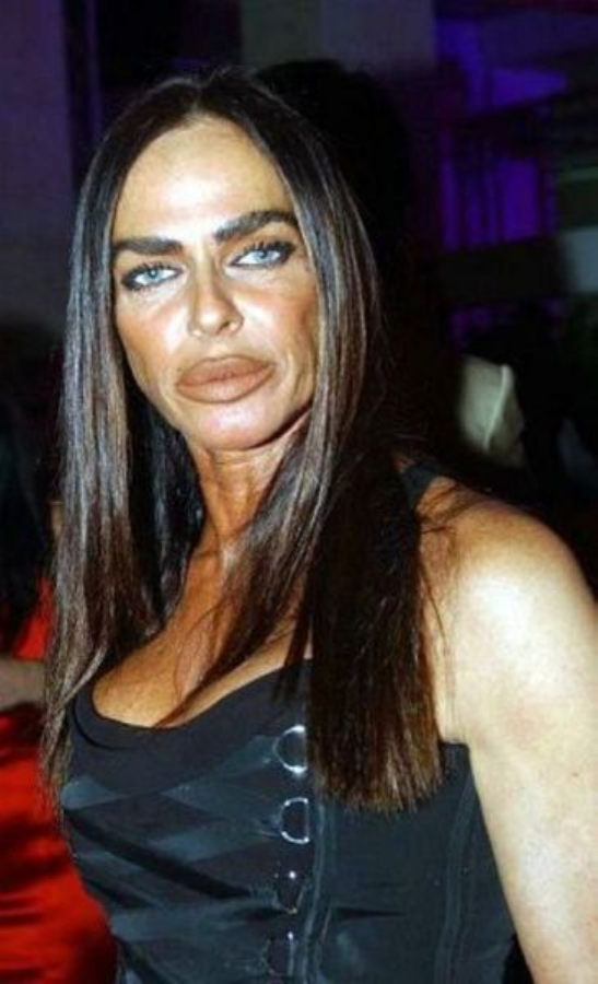 plastic-surgery-fails-0015