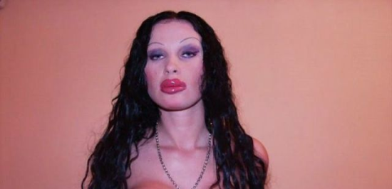plastic-surgery-fails-0010