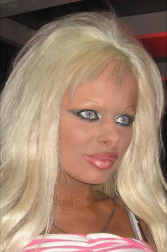 plastic-surgery-fails-0000