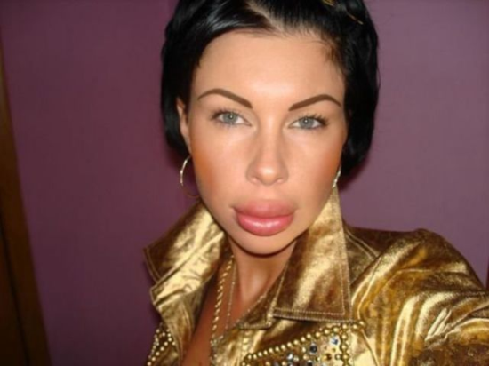 plastic-surgery-fails-0012