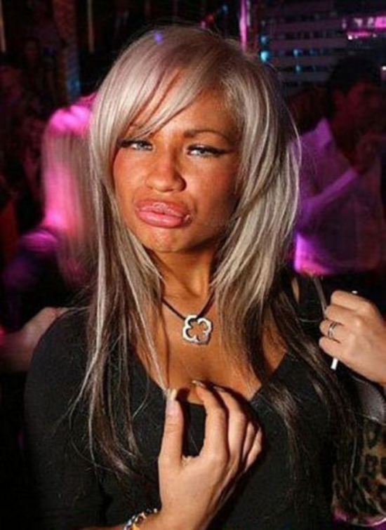 plastic-surgery-fails-0006
