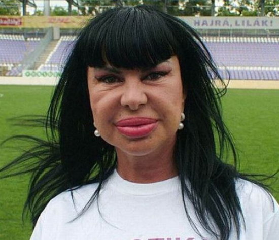 plastic-surgery-fails-0032