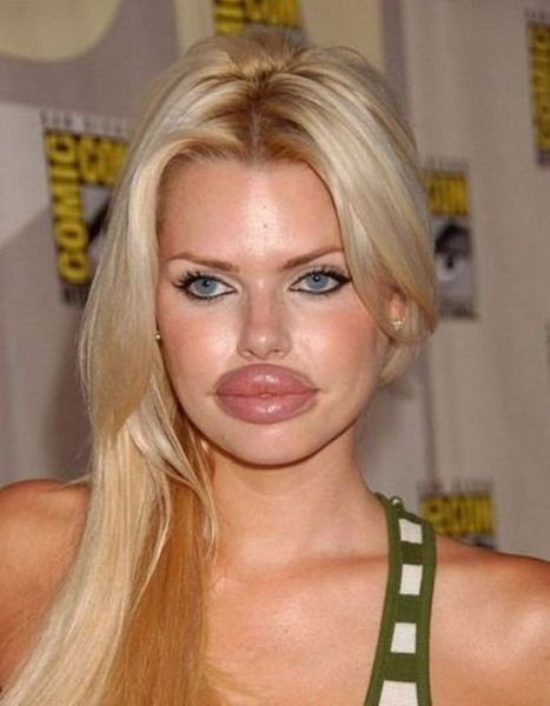 plastic-surgery-fails-0001
