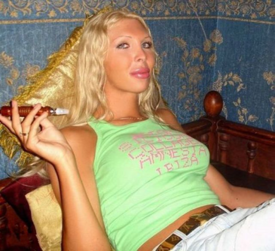 plastic-surgery-fails-0011