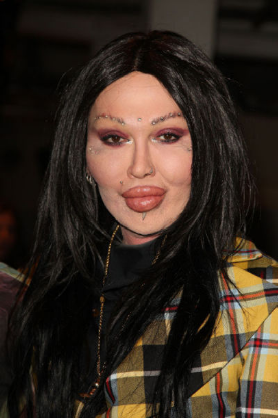 plastic-surgery-fails-0028