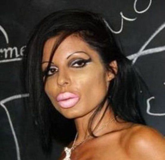 plastic-surgery-fails-0003