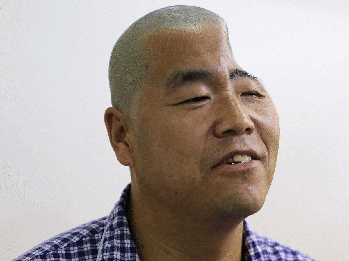 Man_Whose_Head_Was_Crushed-4eba21c7565c52d6f7e1b61744ef009c Man_Whose_Head_Was_Crushed-4eba21c7565c52d6f7e1b61744ef009c