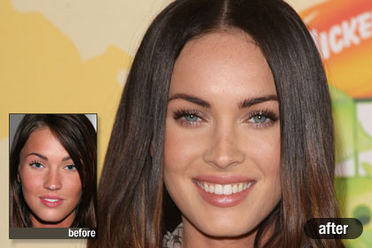 p-celebrity-plastic-surgery-p01