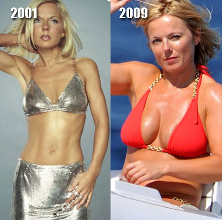 a97834_rsz_geri_halliwell_implants