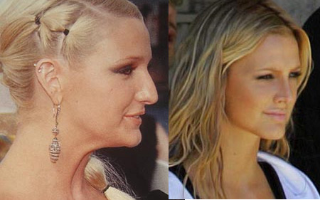 a97834_ashlee_simpson_nose