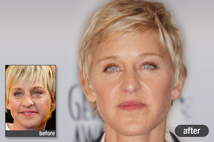 p-celebrity-plastic-surgery-p01