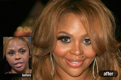 p-celebrity-plastic-surgery-p01