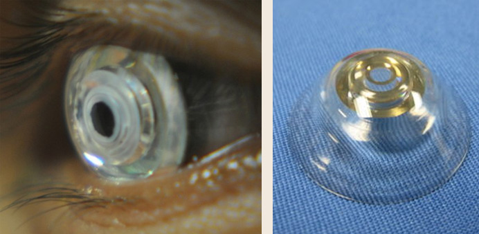 72cd413e-357c-42b7-ae8b-e0cdc3a128b8