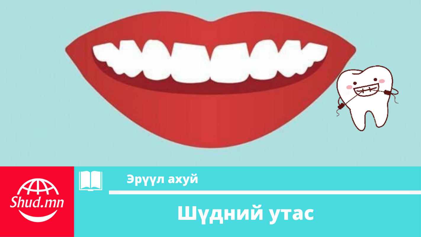 Хүүхдийн шүд хорхойтох өвчин