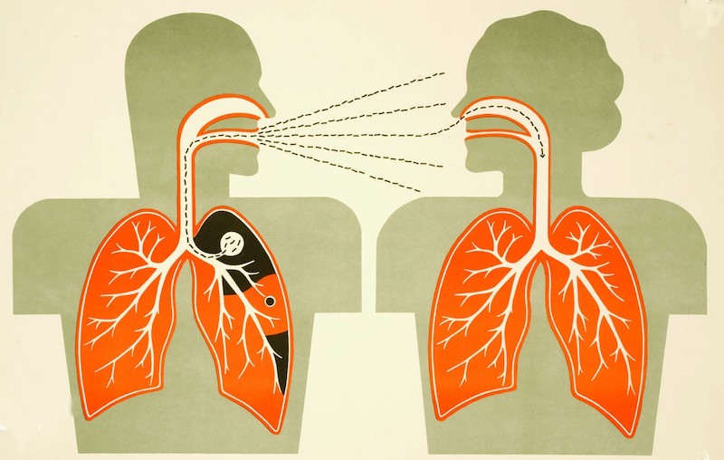 More than 4,000 cases of tuberculosis reported each year