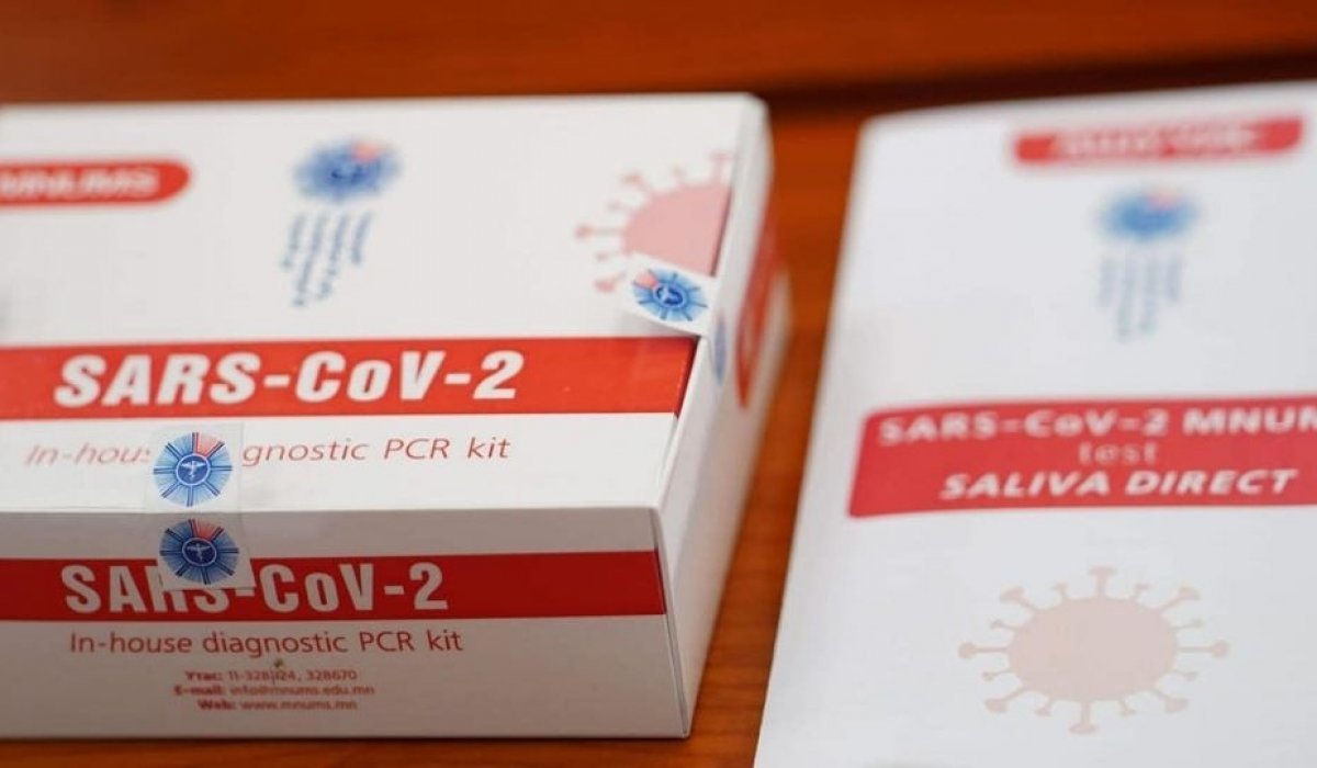 Шүлснээс халдвар илрүүлэх оношлуурыг ирэх даваа гарагаас хэрэглэнэ